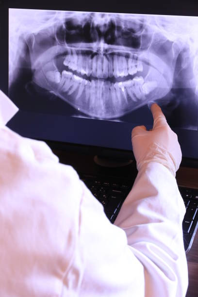 Best Urgent Care for Lost Fillings or Crowns in Newark, NJ